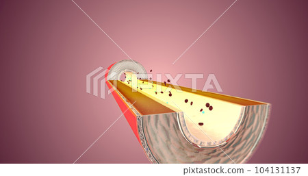 By reducing the amount of angiotensin II, vasopressin is not released. 104131137