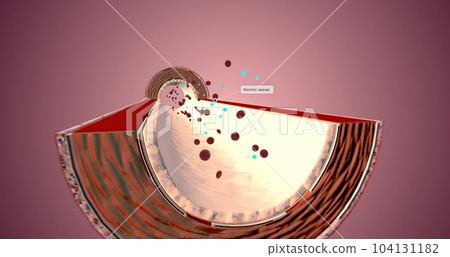 A healthy artery has supple and muscular walls that help blood flow. 104131182