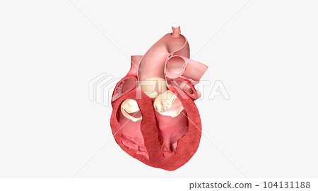 Several heart conditions can cause the septum of the heart to thicken. 104131188