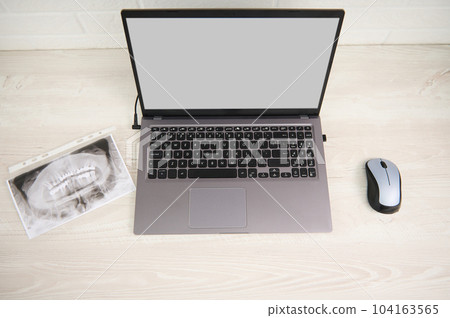 Top view panoramic X-ray photograph, radiographic scanner image of human teeth next to a laptop with blank digital screen on dentist's worktop. Diagnosis. Prevention. Teeth treatment. Dental practice Top view panoramic X-ray photograph, radiographic scanner image of human teeth next to a laptop with blank digital screen on dentist's worktop. Diagnosis. Prevention. Teeth treatment. Dental practice 104163565