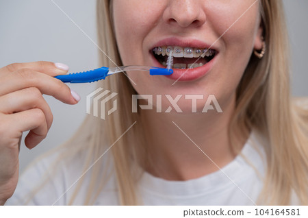 Caucasian woman cleaning her teeth with braces using a brush. Cropped portrait. Caucasian woman cleaning her teeth with braces using a brush. Cropped portrait. 104164581
