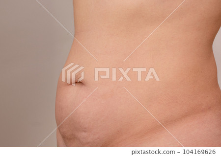 Cropped woman torso with sagging and bloated belly on grey background Cropped woman torso with sagging and bloated belly on grey background 104169626