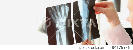 female doctor looks at x-ray of a arm injury in hospital 104176586