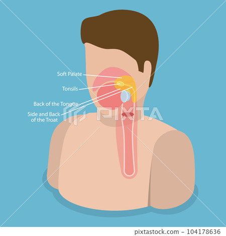 3D Isometric Flat Vector Conceptual Illustration of Oropharynx 104178636
