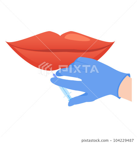 Lip plumping augmentation with filler injection illustration 104229487