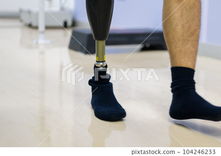 Prosthesis after foot injury and impairment treat 104246233