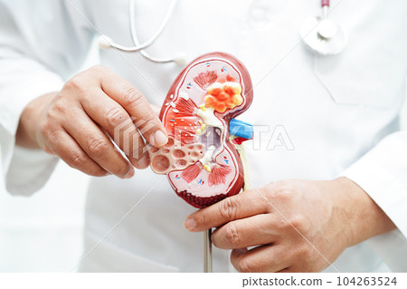 Chronic kidney disease, doctor holding model for treatment urinary system, urology, Estimated glomerular filtration rate eGFR. 104263524