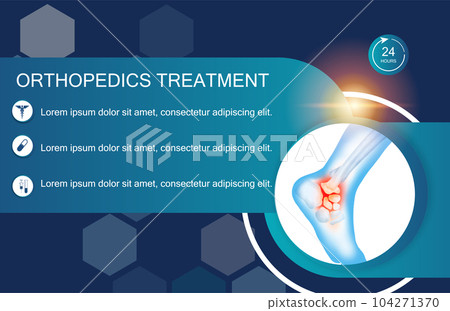 Technology for treatment of ankle and foot bone injury. Abstract traumatology and orthopedics. Medical science in the hospital for body joints. 104271370
