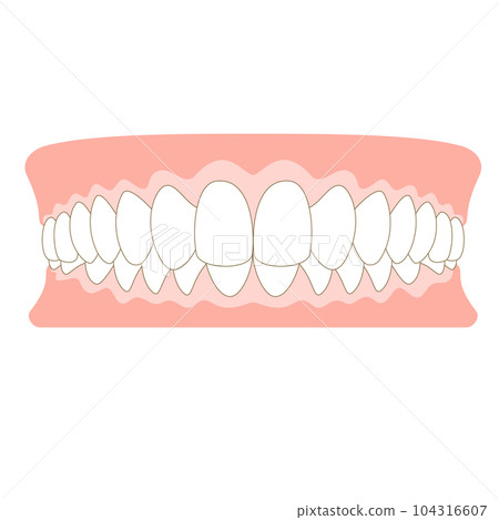 deep occlusion teeth 104316607
