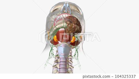 Stage four oral cancer is invasive and has spread beyond the tissue in which it first appeared. Stage four oral cancer is invasive and has spread beyond the tissue in which it first appeared. 104325337