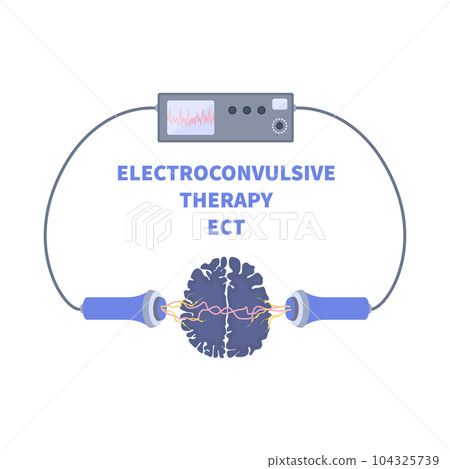 ECT electroconvulsive therapy for severe depression treatment 104325739