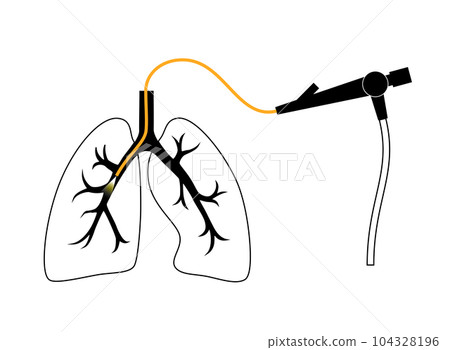 Bronchoscopy procedure concept 104328196