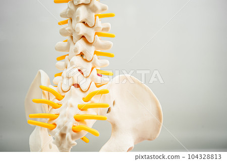 Lumbar spine displaced herniated disc fragment, spinal nerve and bone. Model for treatment medical in the orthopedic department. Lumbar spine displaced herniated disc fragment, spinal nerve and bone. Model for treatment medical in the orthopedic department. 104328813