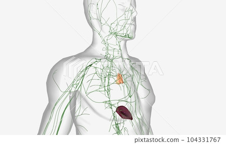 Non Hodgkin is Lymphoma in Lymph node Non Hodgkin is Lymphoma in Lymph node 104331767