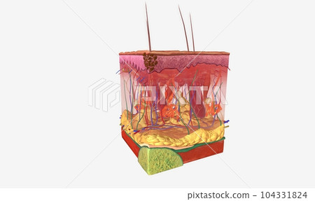 The Melanoma Epidermis Stage 0 The Melanoma Epidermis Stage 0 104331824