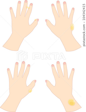 Female hand with blisters 1 104342415