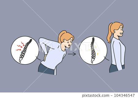 Woman with sick spine near healthy girl with good posture who underwent chiropractic procedure 104346547