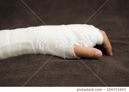 Image of fixing an arm with a fracture, bruise, or sprain 104353403