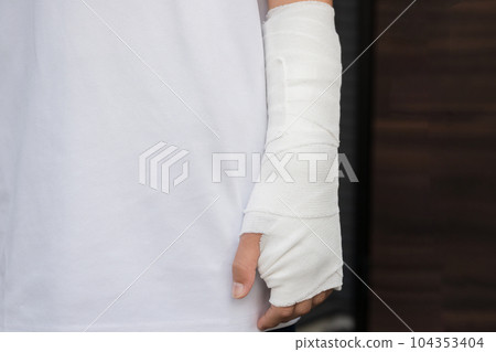 Image of fixing an arm with a fracture, bruise, or sprain Image of fixing an arm with a fracture, bruise, or sprain 104353404
