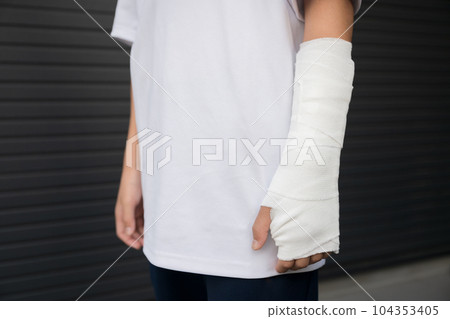 Image of fixing an arm with a fracture, bruise, or sprain Image of fixing an arm with a fracture, bruise, or sprain 104353405