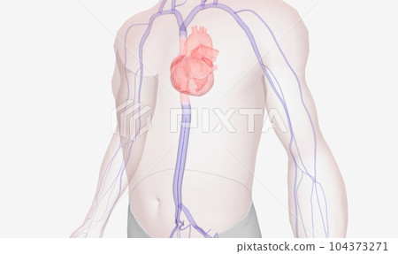 The catheter is passed through a series of veins from the groin 104373271