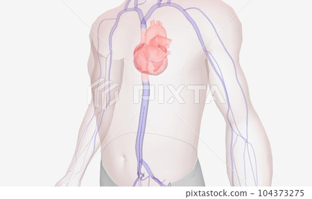 The catheter is passed through a series of veins from the groin 104373275