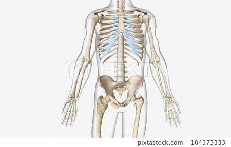 Polyostotic Paget is Disease of Bone Polyostotic Paget is Disease of Bone 104373333