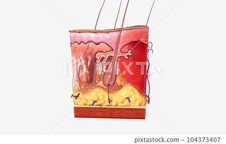 A hemorrhage is bleeding or an abnormal flow of blood. 104373407