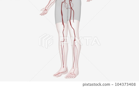 The Lower Extremity Arteries 3D 104373408