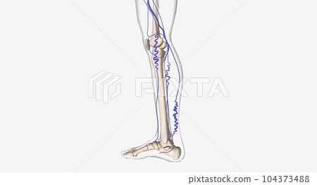 Varicose veins in human leg Varicose veins in human leg 104373488