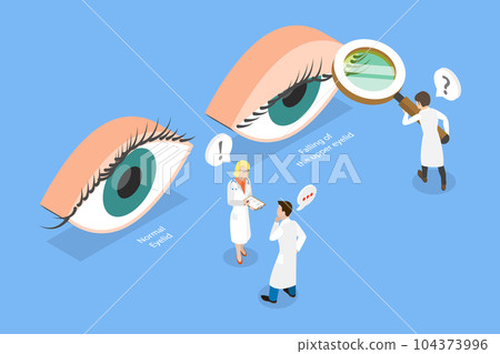 3D Isometric Flat Vector Conceptual Illustration of PTOSIS 104373996