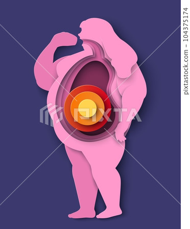 Fat people icon vector woman stomach problem Fat people icon vector woman stomach problem 104375174