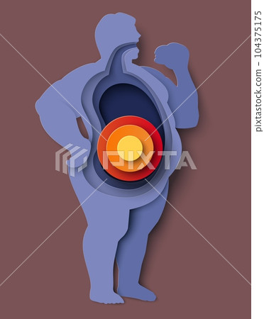 Fat people icon illustration vector man stomach problem Fat people icon illustration vector man stomach problem 104375175