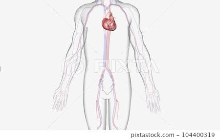 An intra-aortic balloon pump is a flexible tube attached to an inflatable balloon. An intra-aortic balloon pump is a flexible tube attached to an inflatable balloon. 104400319