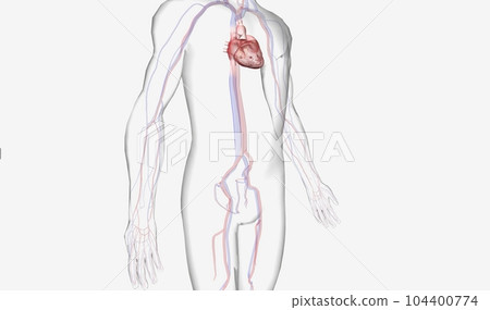 An intra-aortic balloon pump is a flexible tube attached to an inflatable balloon. An intra-aortic balloon pump is a flexible tube attached to an inflatable balloon. 104400774