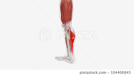 The calf muscles (gastrocnemius) are the most common area of a m 104400845