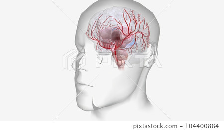 Hemorrhagic stroke is an urgent medical condition characterized Hemorrhagic stroke is an urgent medical condition characterized 104400884