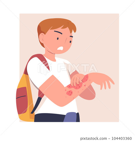 Man Character with Skin Problem Suffering Scratching Itching Arm Vector Illustration 104403360