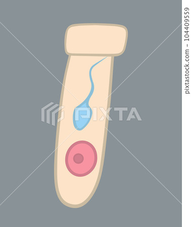 Artificial insemination vector isolated illustration. In vitro fertilization. Egg donation. Sperm reporting. Freezing sperm and eggs. 104409559