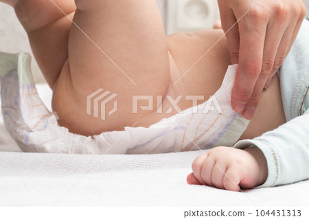The mother fastens the fasteners and changes the baby's diaper, close-up. Copy space for text The mother fastens the fasteners and changes the baby's diaper, close-up. Copy space for text 104431313