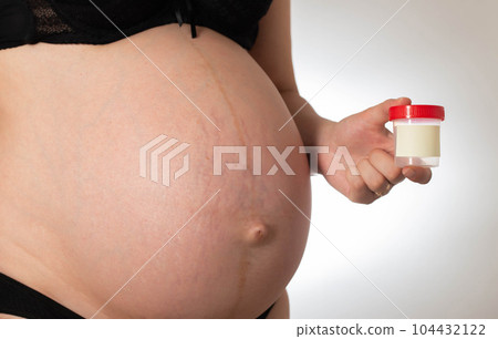 A pregnant girl holds a jar in her hand for collecting urine tests. Koznept urinalysis during pregnancy, protein and acetone in the urine. Research on genital infections, bacteria and preeclampsia. 104432122