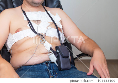 An obese man undergoes a Holter monitoring of the heart. A modern method for studying the heart in caodiology. Arrhythmia and ischemic disease. Medic An obese man undergoes a Holter monitoring of the heart. A modern method for studying the heart in caodiology. Arrhythmia and ischemic disease. Medic 104433409