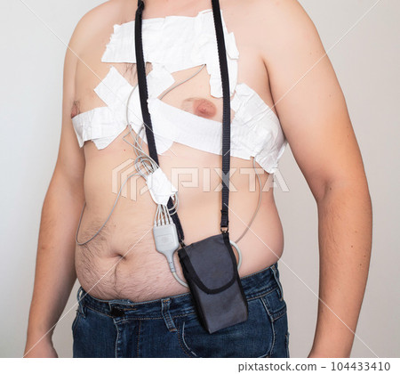 Cardiological procedure for the study of the heart Holter monitoring. Identification of heart diseases, blood supply and disorders of the heart, heart failure. 104433410