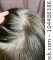 thin hair woman 104486386
