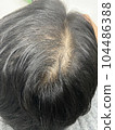 Thinning hair of a man in his 40s 104486388