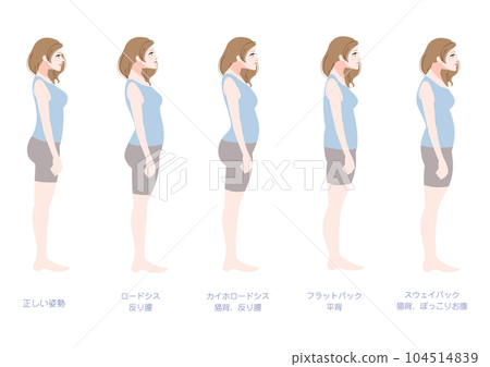 Bad posture female set seen from the side Bad posture female set seen from the side 104514839