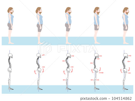 從側面看不良姿勢女套裝 104514862