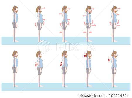 Bad posture female set seen from the side 104514864