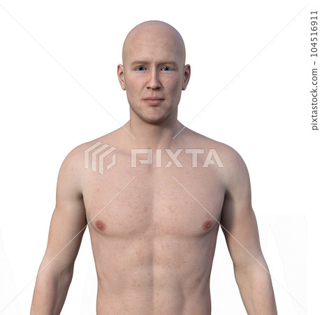 A 3D photorealistic illustration showcasing the upper half part of a man devoid of hair, revealing his skin and facial features 104516911