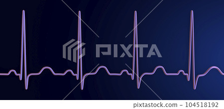 Electrocardiogram ECG displaying sinus tachycardia, 3D illustration 104518192